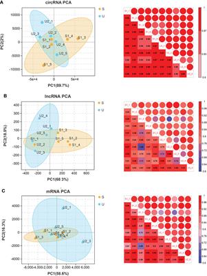 Identification of potential biomarkers and pathways associated with carotid atherosclerotic plaques in type 2 diabetes mellitus: A transcriptomics study
